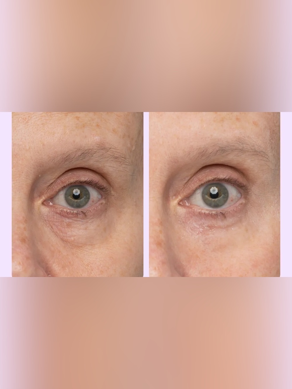 GoPure Instant Lift Eye Gel - Picture 6 of 6